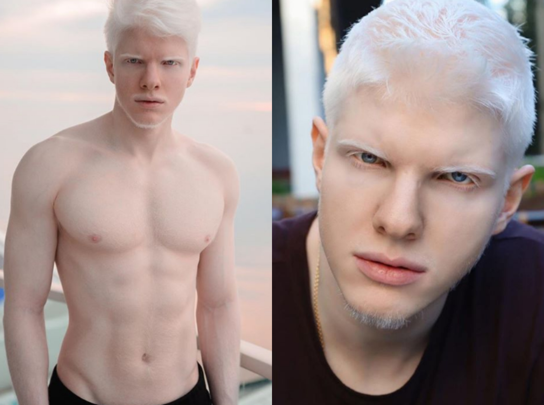 Hot albino men